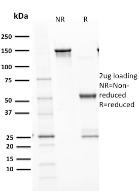 Data from SDS-PAGE analysis of Anti-p53 Tumor Suppressor Protein antibody (Clone TP53/1799R). Reducing lane (R) shows heavy and light chain fragments. NR lane shows intact antibody with expected MW of approximately 150 kDa. The data are consistent with a high purity, intact mAb.